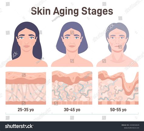 Aging Process Face Skin Structure Changes Stock Vector Royalty Free