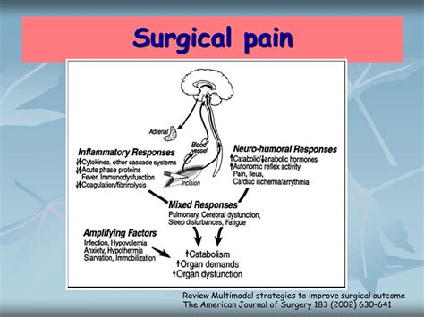 PPT Post Operative Pain Management PowerPoint Presentation Free