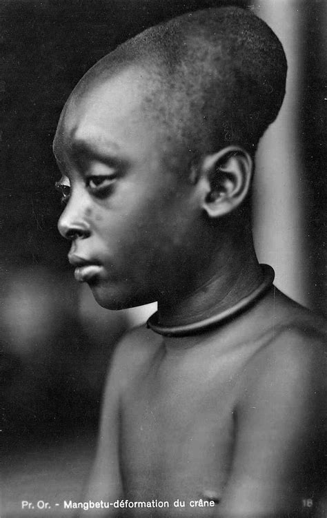 Africa Mangbetu Artificial Cranial Deformation Congo Ca 1929