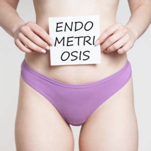 Un estudio mundial demuestra que la endometriosis tiene raíces