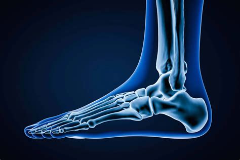 Charcot Foot Diagnosis And Treatment Options Northwest Extremity