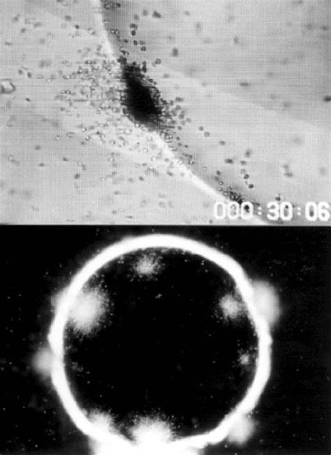 Massing and encysting of zoospores (upper) and germinating of ...