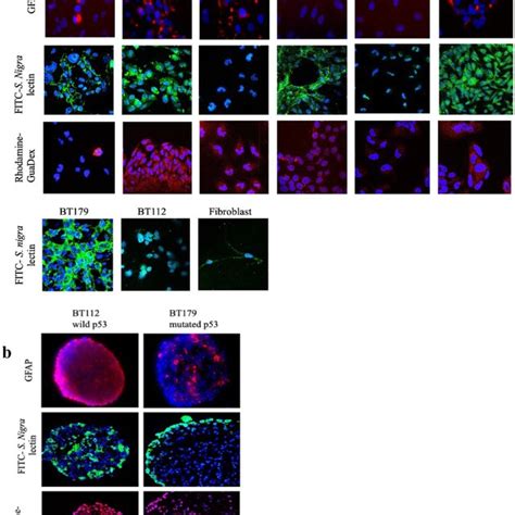 Confocal Microscopy Images A Monolayers Glioma Cell Lines GFAP