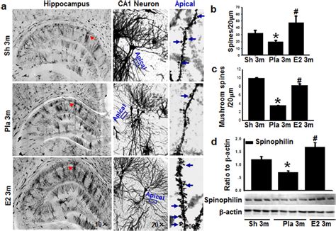 Micrograph Of Golgi Staining Shows Apical Dendrites From Hippocampal