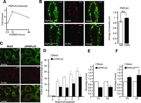 Pnpla3 Is Overexpressed Upon Intracellular Lipid Missorting And Plays A