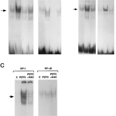 Induction Of Ap 1 And Nf B Binding Activities By Tbhq Bha And Pdtc Download Scientific