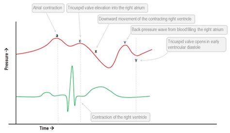 Cardiovascular Monitoring & Complications - NCC On Call