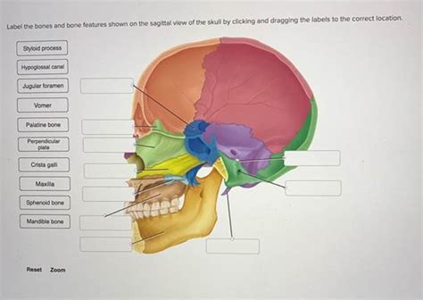 Solved Label The Bones And Bone Features Shown On The Sagittal