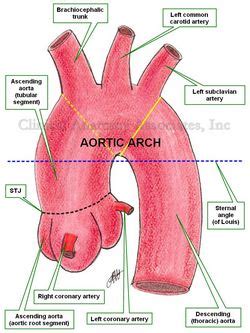 Ascending aorta