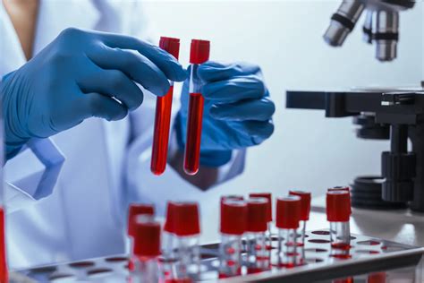 Plasma Sample For Research IProcess