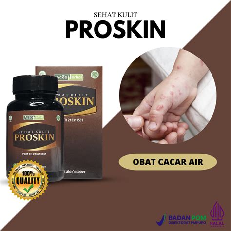 Jual Obat Cacar Air Kulit Gatal Ruam Tidak Enak Badan Demam