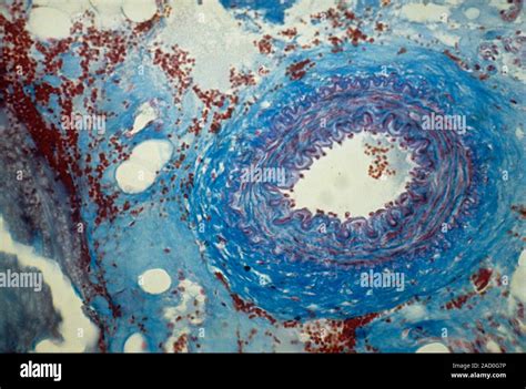 Arteriole Light Micrograph Of A Section Through A Small Human Artery