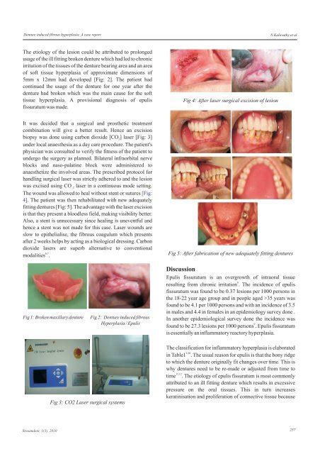 Denture