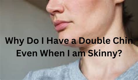 Why Do I Have A Double Chin Even When I Am Skinny Learn More