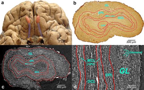 A Photographic Image Of The Human Brain With Two Olfactory Bulbs