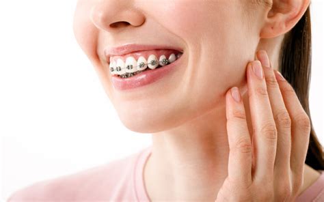 What Are The Different Types Of Braces Level Orthodontics