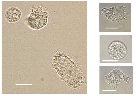 Acanthamoeba Keratitis The Emerging Vision Threatening Corneal Disease Intechopen