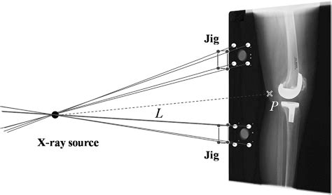 Figure 3 From Analysis Of Weight Bearing Kinematics Of Posterior