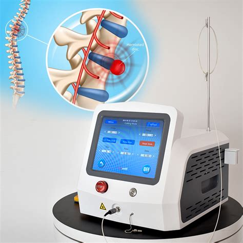 Hot Sale Diode Laser 980nm1470nm Pldd Laser Surgery Fiber Pldd Surgery