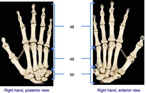 Diagram Of Bones Of Hand And Wrist Quizlet