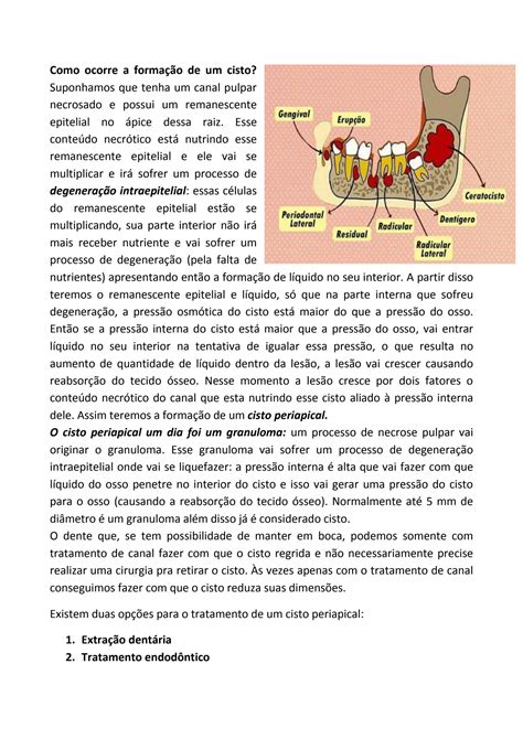 SOLUTION Tratamento De Cistos E Tumores Odontog Nicos Studypool