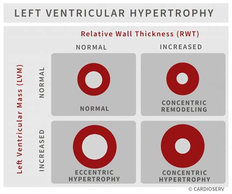 Understanding Lvh Part How To Measure Lv Mass And Diagnose Lvh