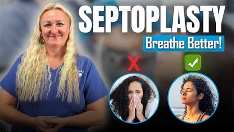 Septoplasty And Deviated Septum A Comprehensive Guide