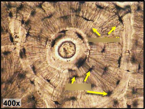 Ground Compact bone Lacunae and canaliculi Diagram | Quizlet