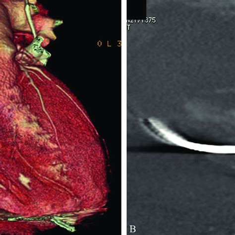 Pdf Review Imaging Integrato Rx Eco Tc In Terapia Intensiva Imaging