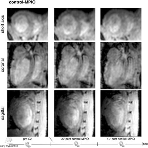 Enlarged In Vivo 3d Mri 2 Days After Induction Of Myocarditis With