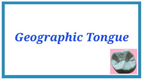 Geographic Tongue Important Notes Developmental Disturbances Of Tongue Oral Pathology