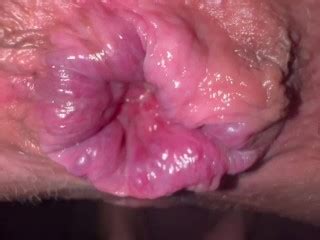 Tmd Ass Fuckers Monster Hemorrhoid Fs Pornhub