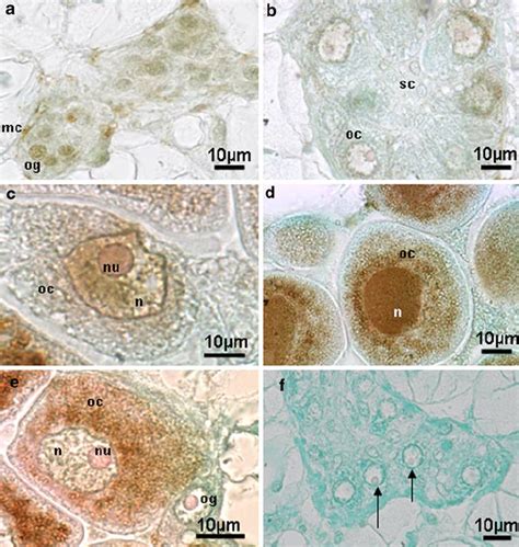 Immunohistological Detection Of Pcna In Female Gonadal Tubule Of