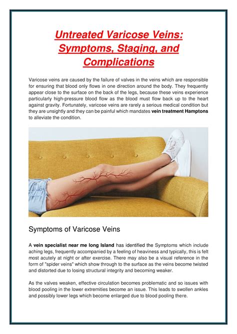 Ppt Untreated Varicose Veins Symptoms Staging And Complications