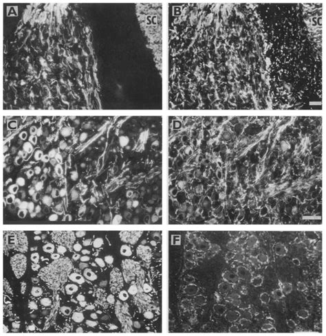 Double Label Immunofluorescence Analysis Of Frozen Sections Of Dorsal Download Scientific