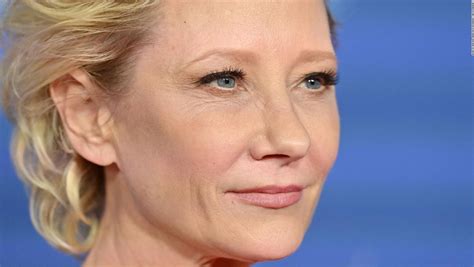 Actress Anne Heche Has A Long Recovery Ahead After Car Accident The