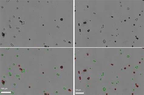 AsPC 1 Logos Biosystems Advanced Imaging Solutions For Research