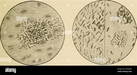 Salmonella Typhi Under A Microscope