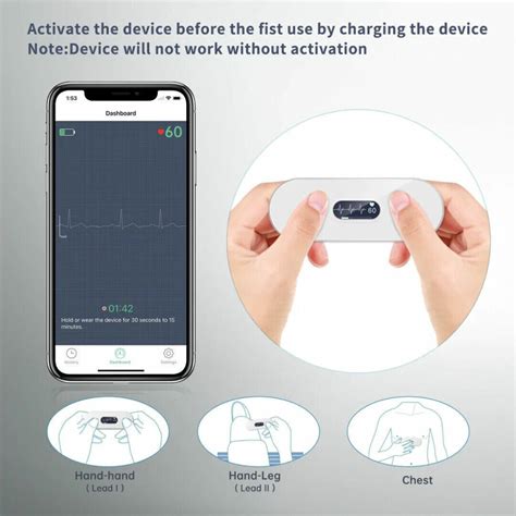 Duoek S Bluetooth Ecg Monitor Wellue Medische Vakhandel