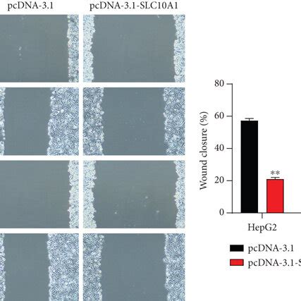 SLC10A1 Expressed Lowly In HCC Cells And Suppressed Its Proliferation