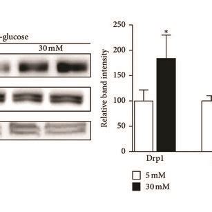 Effect Of High Glucose Hg Conditions On Mitochondrial Dynamics