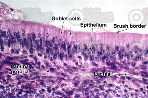 Rana Sp Frog Small Intestine Transverse Section 500x Rana Sp