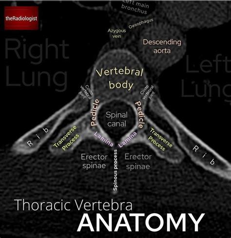 Thoracic vertebra - MEDizzy