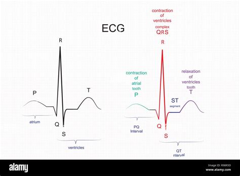 Ecg Heart Rate Chart