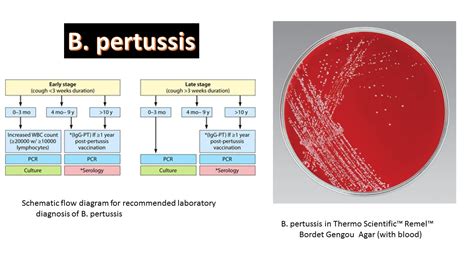 Bordetella: Introduction, Morphology, Pathogenecity, Lab Diagnosis,Treatm