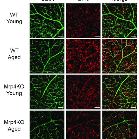 Immunohistochemical Staining Results Of Whole Mount Retina Retinal