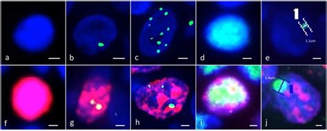 Double Immunofluorescent Studies Identified Five Types Of P53 Binding