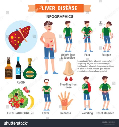 Liver Disease Infographic Template Design Royalty Free Stock Vector