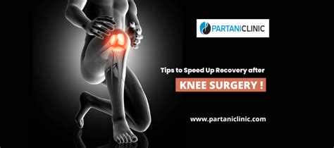 Tips To Speed Up Recovery After Knee Surgery Dr Arun Partani