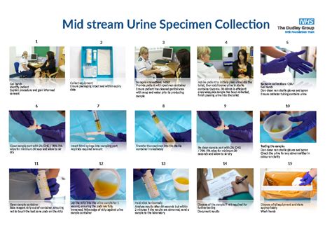 urinanalysis oct medical practices mid stream urine specimen